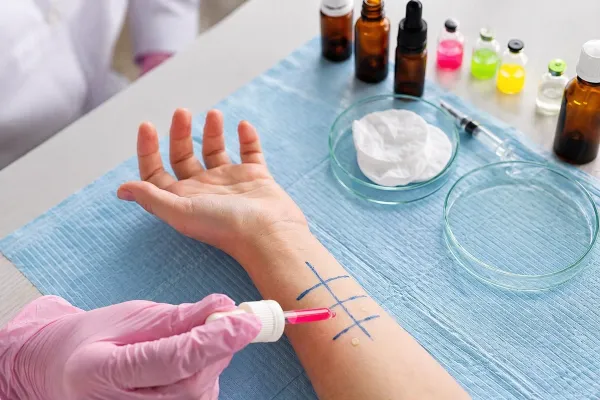 Alergie: proč jich přibývá a co s tím můžeme dělat