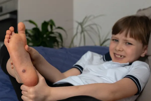 Bradavice u dětí a mýty o léčbě